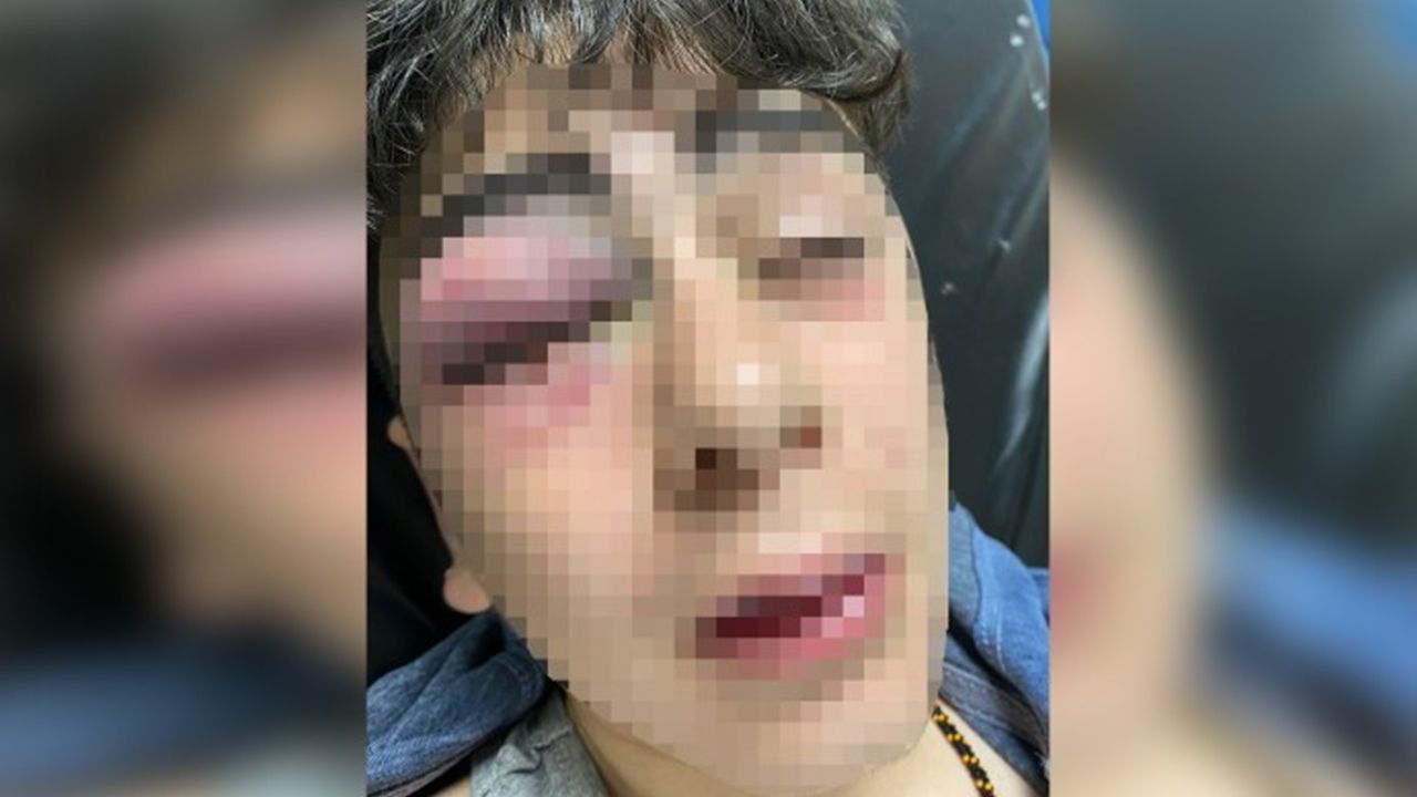 Lice’de 14 yaşındaki çocuğa polis şiddeti
