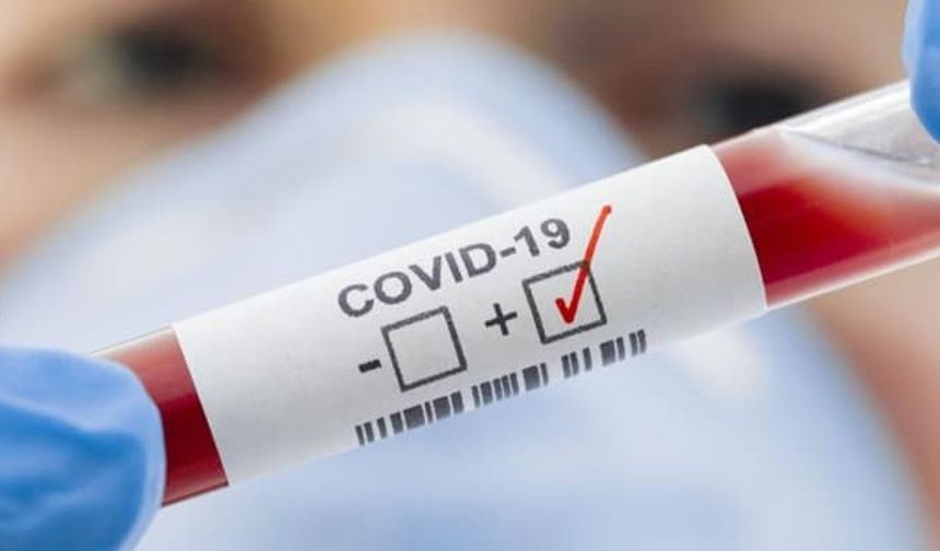 DSÖ: Covid-19 öngörülemeyen özelliklere sahip yeni varyantlara dönüşme yeteneğini koruyor